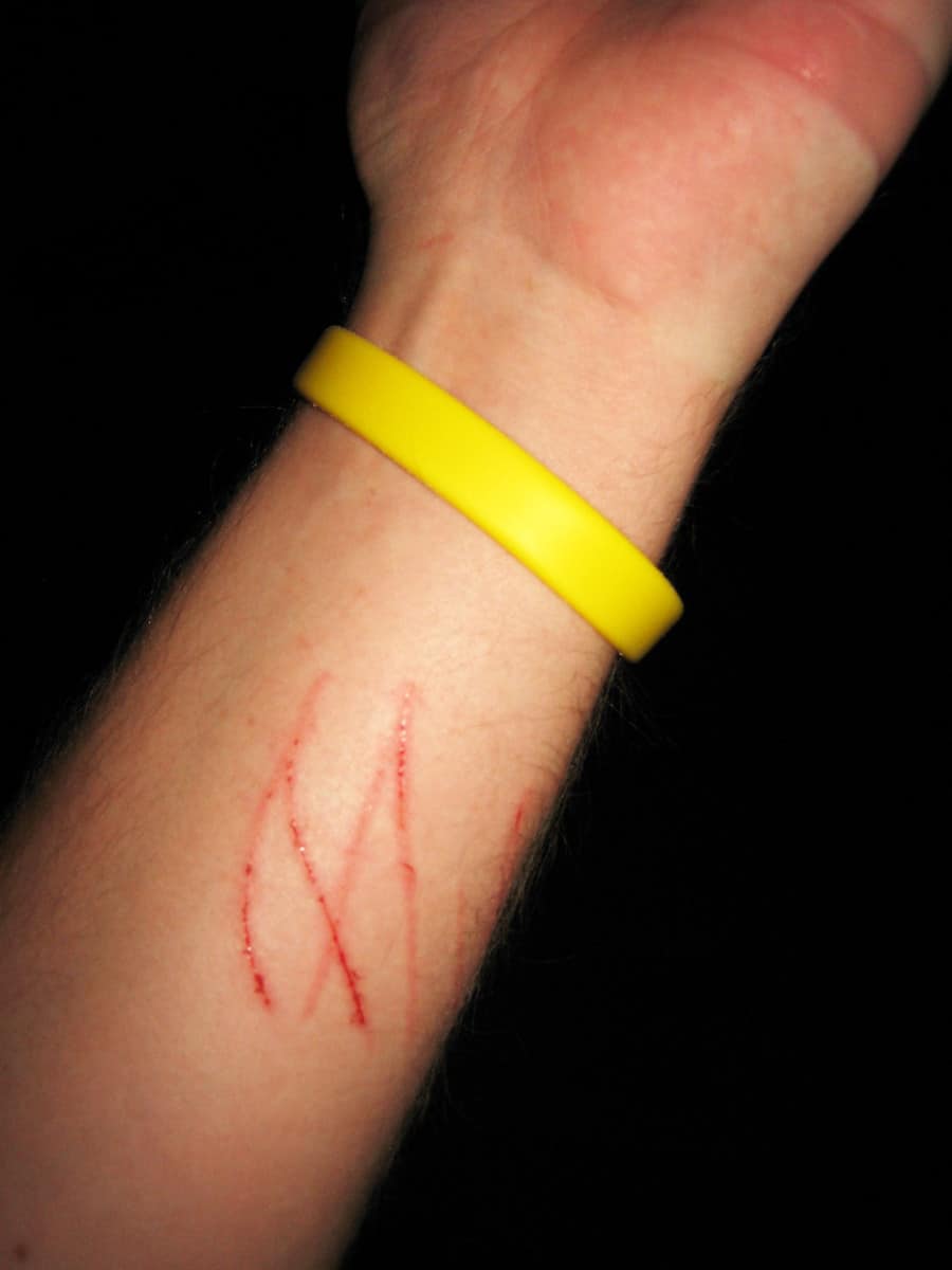 Rabbit Scratches What to do when your rabbit scratches you.